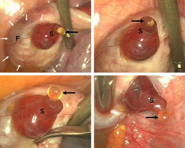 اضغط على الصورة لعرض أكبر.   الإسم:	600px-Human_ovulation_01.jpg  مشاهدات:	2  الحجم:	44.2 كيلوبايت  الهوية:	735890