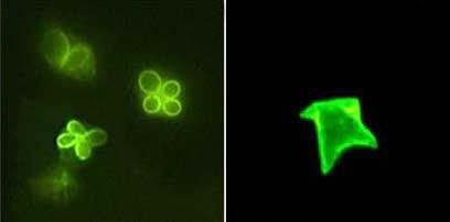 شعبة الجرثوميات ذات الأكياس القطبية .Phylum : Myxospora.