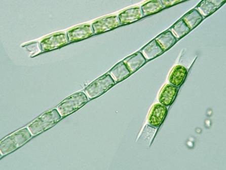 شعبة الجرثوميات الدقيقة ذات الخيوط اللولبية .Phylum : Microspora.